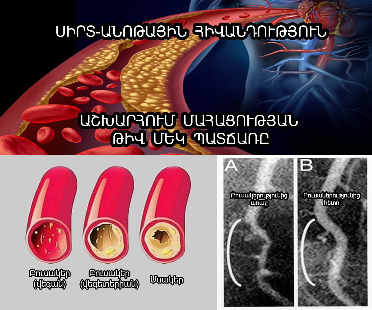 Մի քիչ կտրվենք աշխարհաքաղաքականությունից և քննարկենք մի հարց, որը նույնքան կարևոր է, որքան ընթացող թեժ դեպքերը աշխարհի տարբեր անկյուններում....