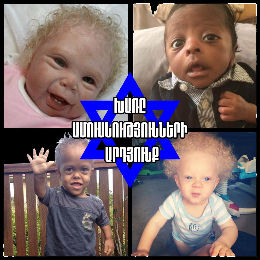 Տասնամյակներ շարունակ (հատկապես Երկրորդ աշխարհամարտի ավարտից հետո) ջհուդական մեդիան քարոզել է այն լկտի ու մեծ սուտը, թե «խառնածին երեխաները ավելի գեղեցիկ են», մինչդեռ իրականությունը լիովին հակառակն է։ Գիտական տվյալները ցույց են տալիս, որ...